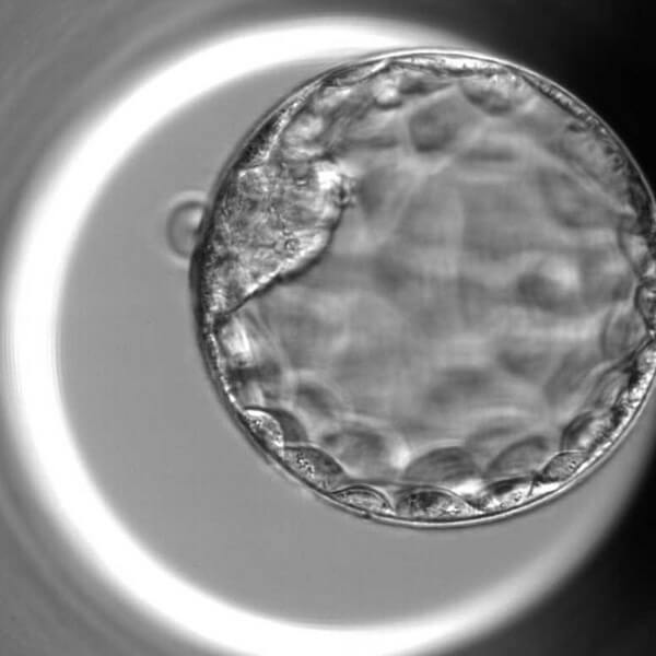 Supporting Your Reproductive Wellbeing
