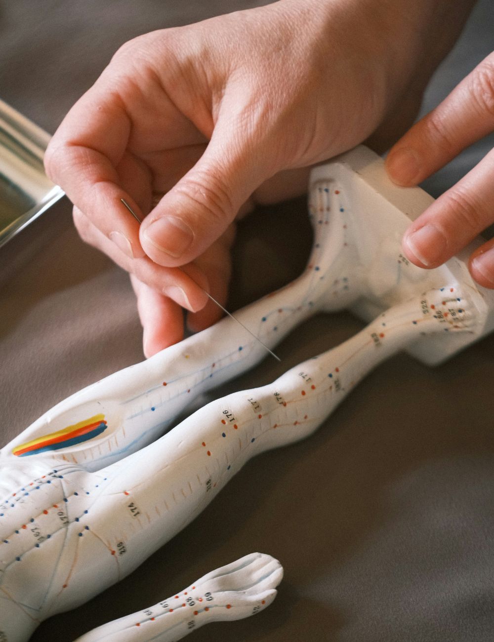 Fertility acupuncture 1